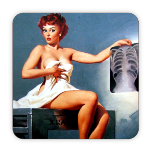 Костер (подставка под кружку) Pin up